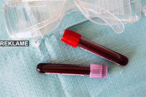 Fa en ren klinik med disse 3 tips